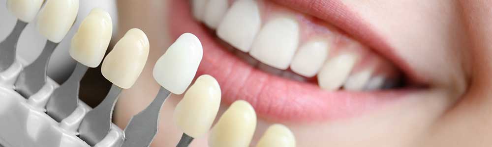 Unsere Leistungen Zahnersatz