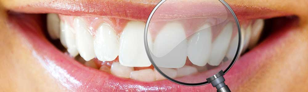 Unsere Leistungen Zahnästhetik